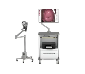 Digital Electronic Colposcope