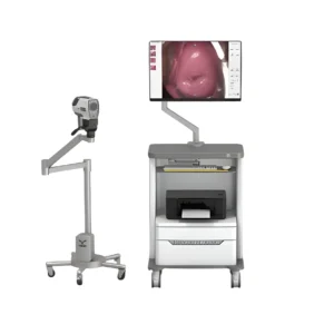 Digital Electronic Colposcope