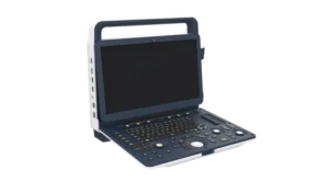 Portable Full Digital Color Doppler Ultrasound